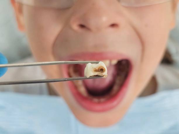  Fort Recovery, OH Emergency Dentist Pros